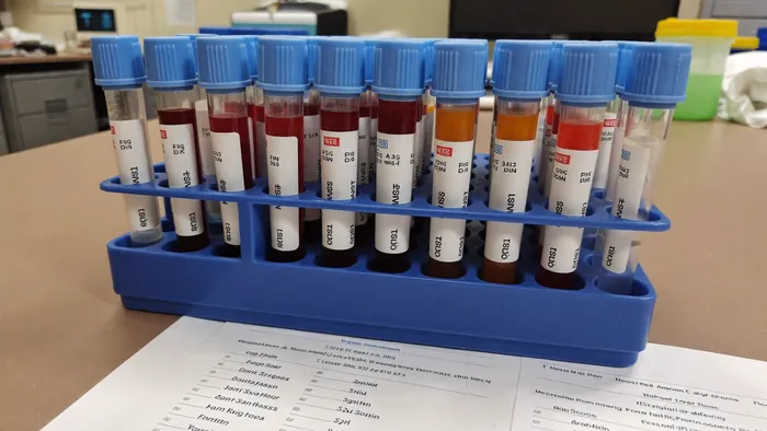 Laboratory blood sample tubes and results